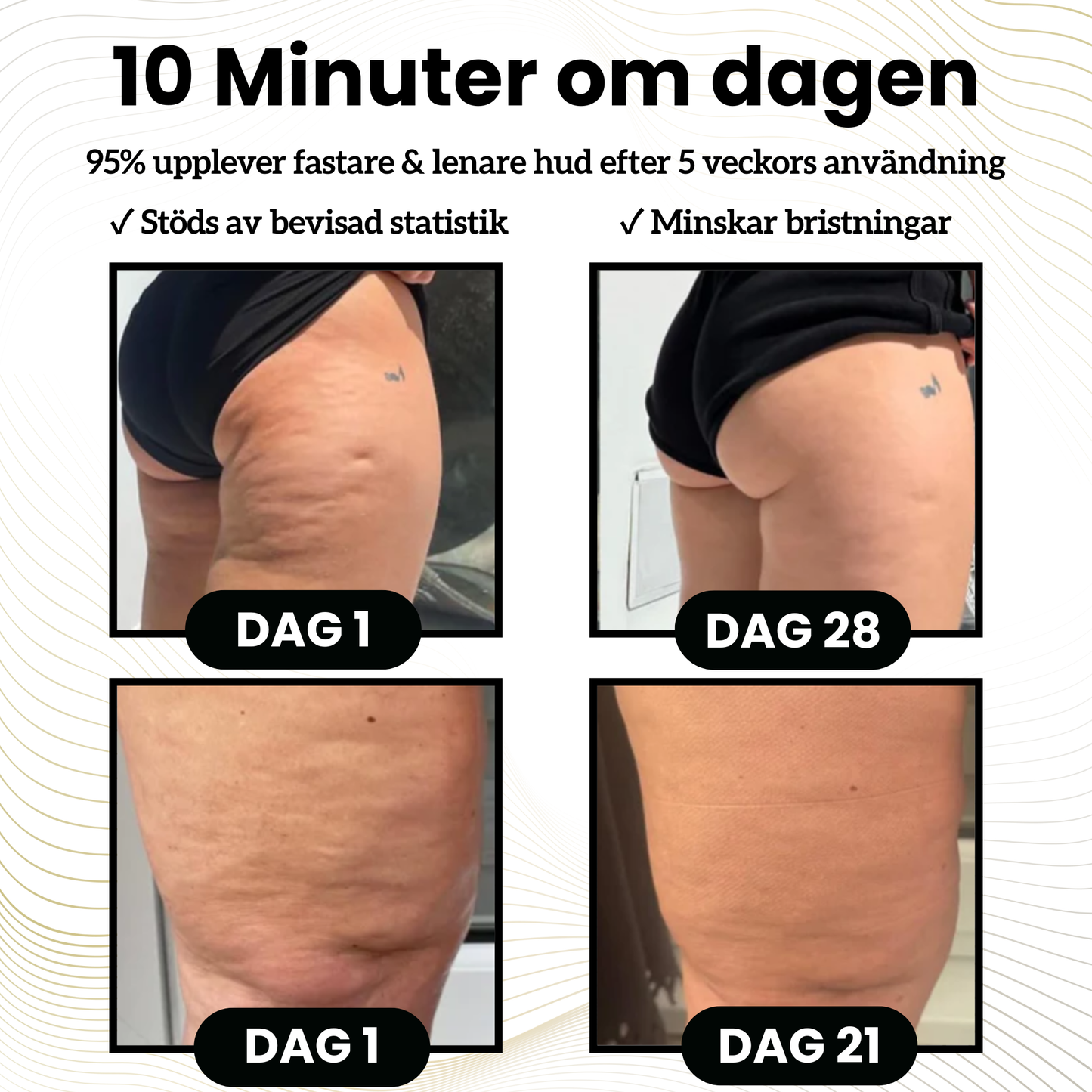 CelluShape™ - För fastare och lenare hud