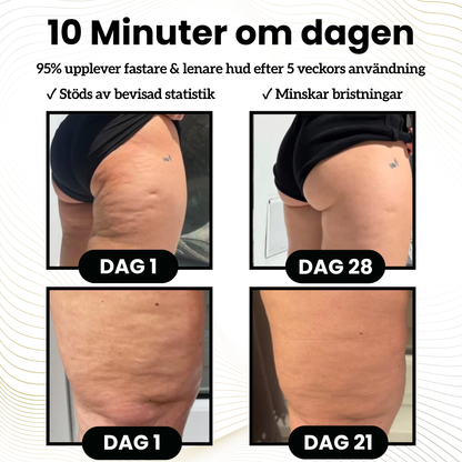 CelluShape™ - För fastare och lenare hud